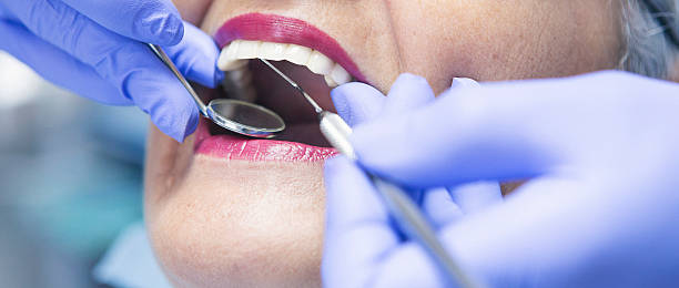 Best Emergency Root Canal Treatment in Wesson, MS